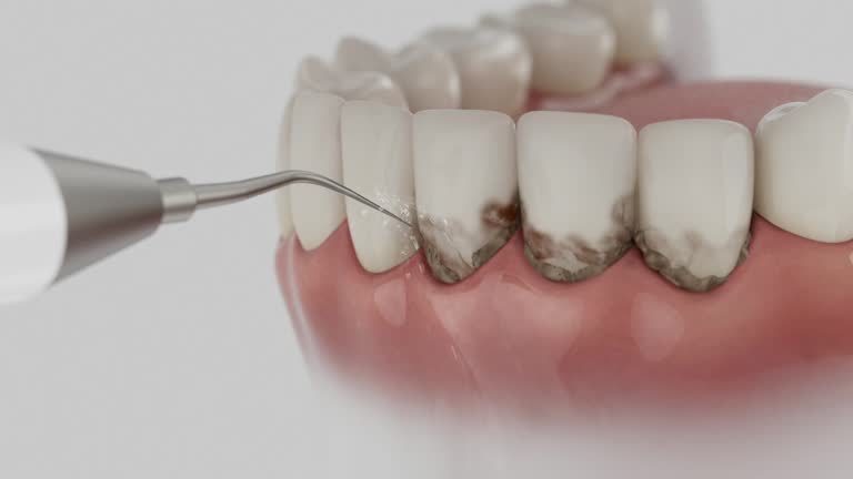 Reliable Dental contractor in Weston, WI by Smile Center Dentistry